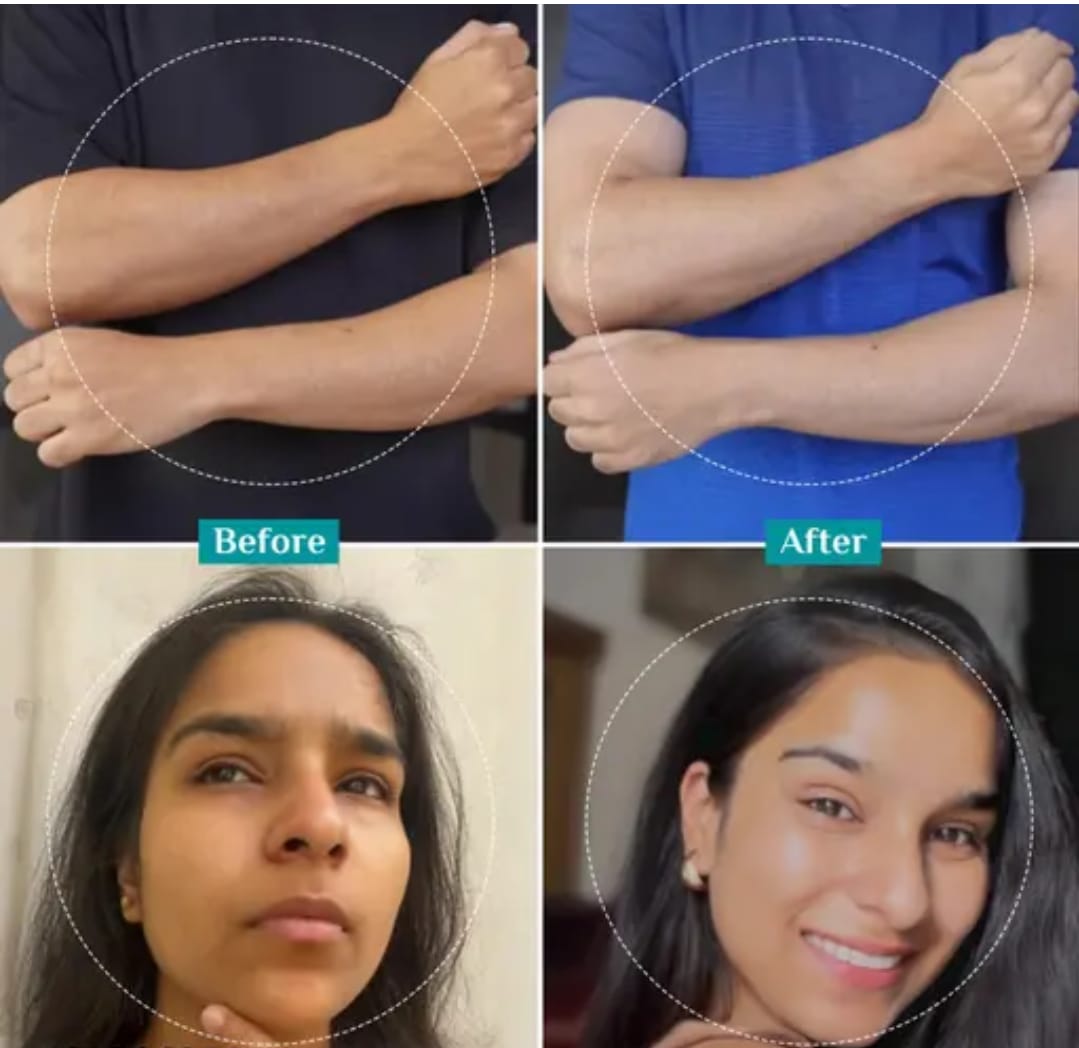 Peeling Solution 10ml For Face